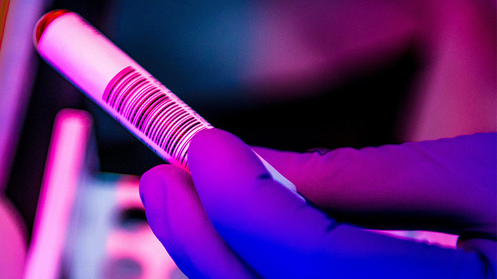 EPI LAB – EPIDEMIOLOGY REFERENCE LABORATORY